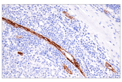 Immunohistochemistry Image 4: CD62P/P-Selectin (E8Q1W) Rabbit Monoclonal Antibody