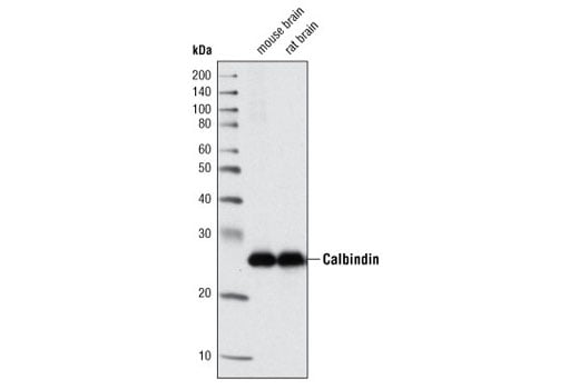 Western Blotting Image 1: Calbindin (C26D12) Rabbit mAb