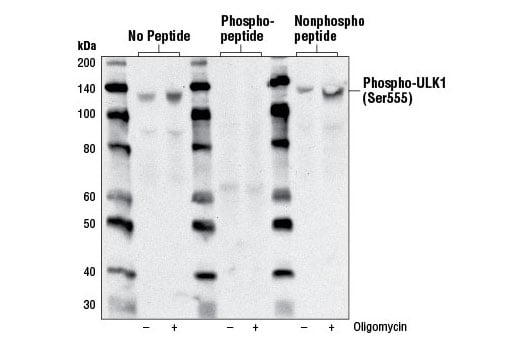 Western Blotting Image 3: Phospho-ULK1 (Ser555) (D1H4) Rabbit Monoclonal Antibody