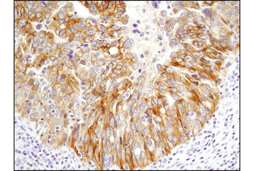 Immunohistochemistry Image 3: HER3/ErbB3 (D22C5) Rabbit Monoclonal Antibody