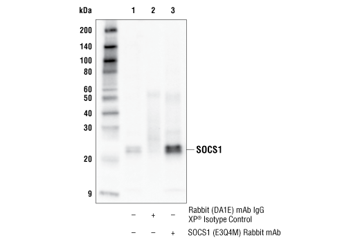 Immunoprecipitation Image 1: SOCS1 (E3Q4M) Rabbit Monoclonal Antibody