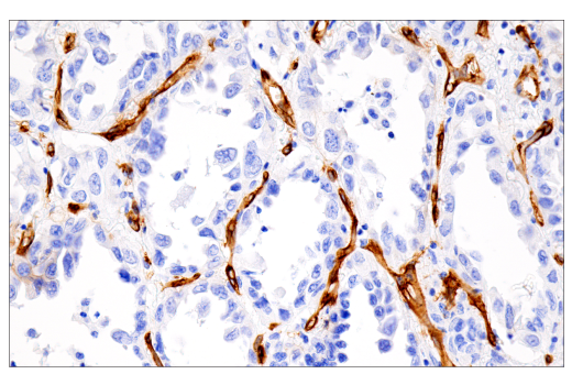 undefined Image 66: Pericyte Antibody Sampler Kit