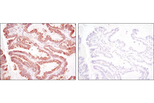 Immunohistochemistry Image 4: RSK2 (D21B2) Rabbit Monoclonal Antibody