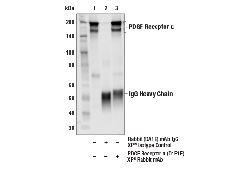 Immunoprecipitation Image 1: PDGF Receptor alpha (D1E1E) Rabbit Monoclonal Antibody