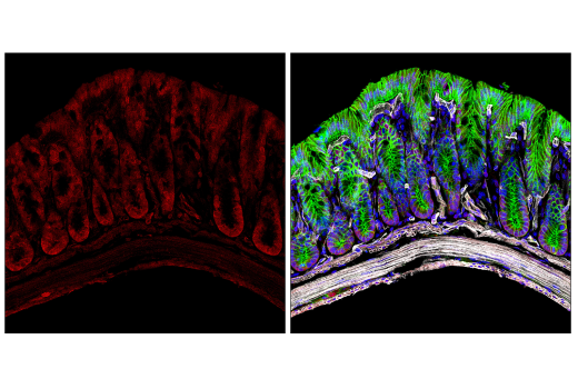 Immunofluorescence Image 1: SUMO-1 Antibody
