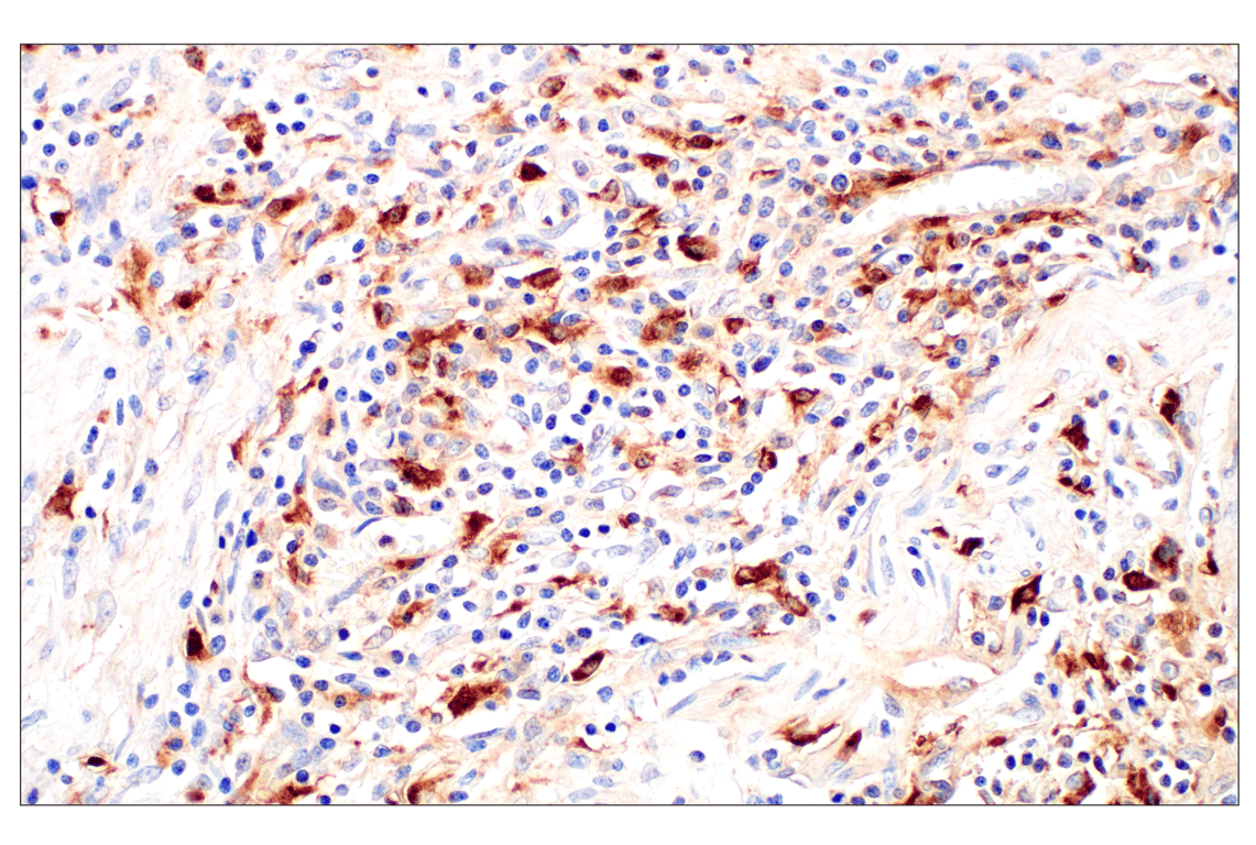 Immunohistochemistry Image 6: Cathepsin L (E3R3P) Rabbit mAb