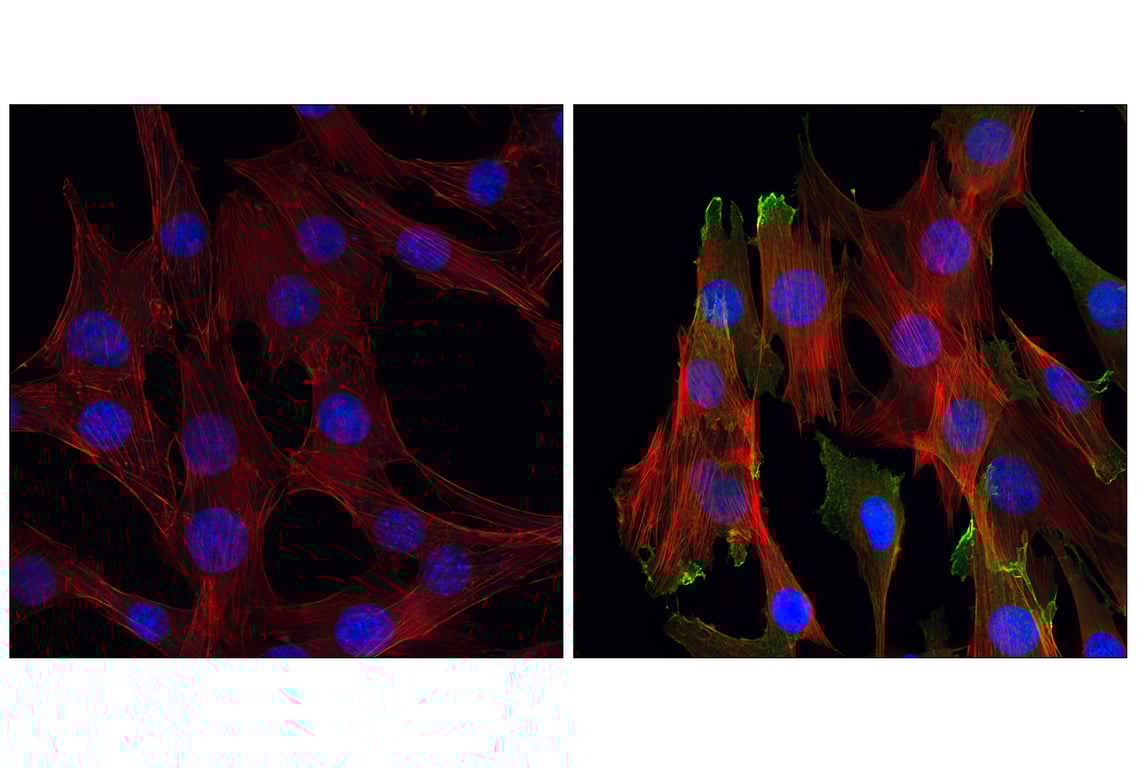 Immunofluorescence Image 1: Phospho-Akt (Ser473) (D9E) Rabbit Monoclonal Antibody (BSA and Azide Free)