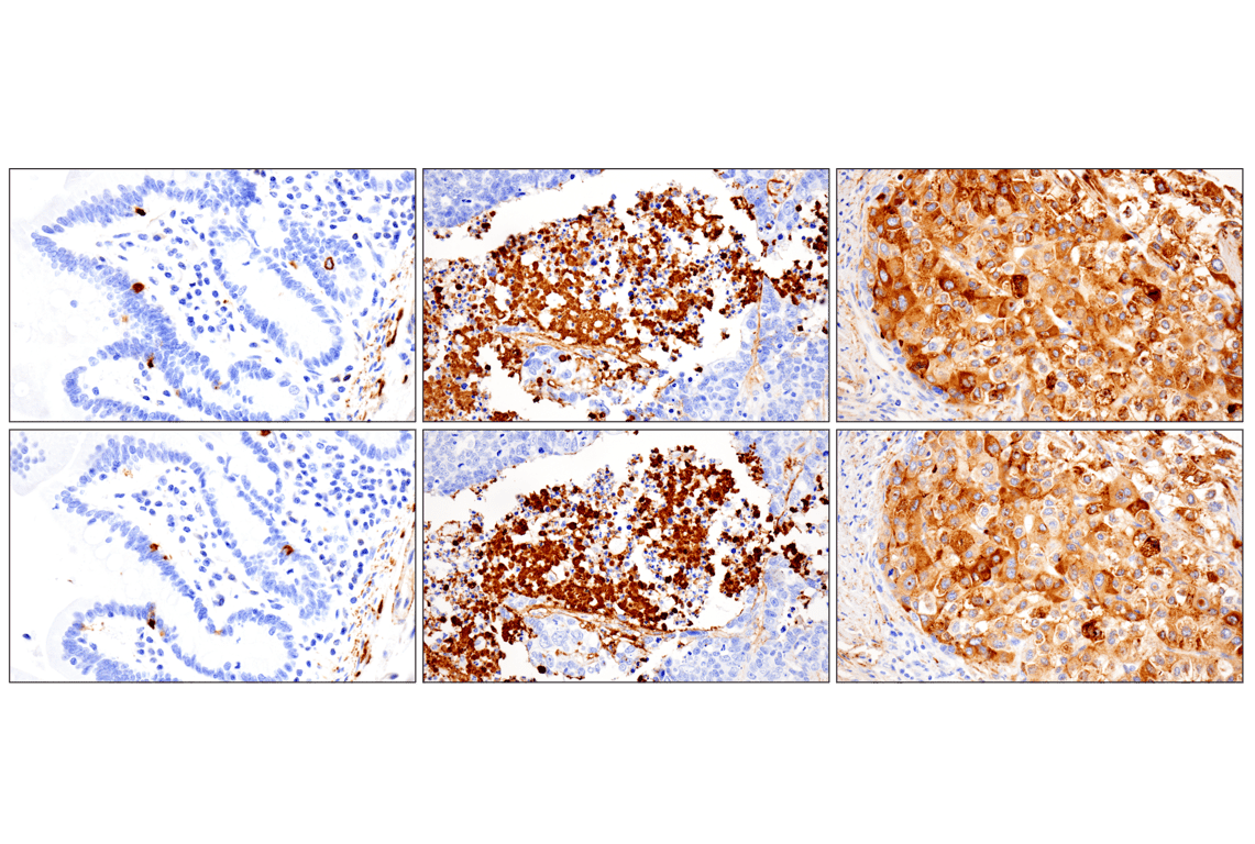 Immunohistochemistry Image 13: Vitronectin (F8D3L) Rabbit Monoclonal Antibody