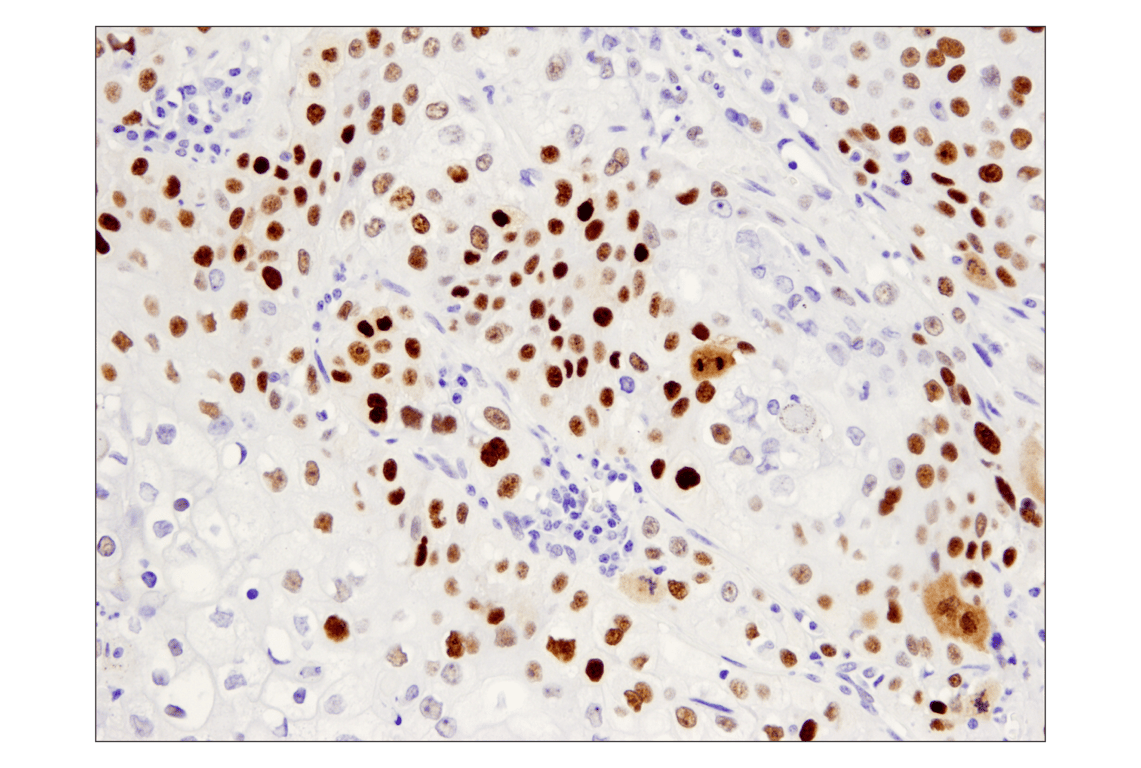 Immunohistochemistry Image 3: p53 (DO-7) Mouse Monoclonal Antibody