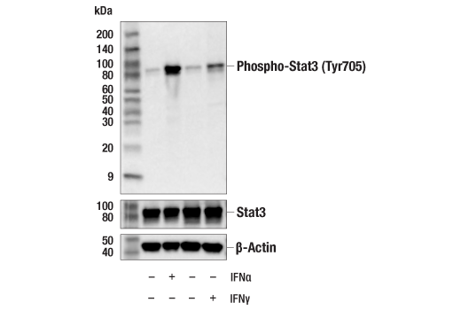 Western Blotting Image 2: Phospho-Stat3 (Tyr705) (D3A7) Rabbit Monoclonal Antibody