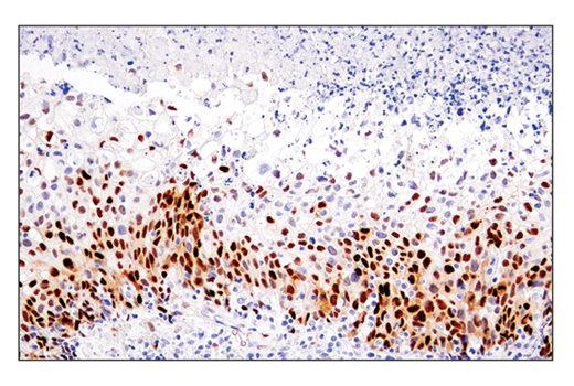 Immunohistochemistry Image 1: Cyclin D1 (E3P5S) Rabbit Monoclonal Antibody
