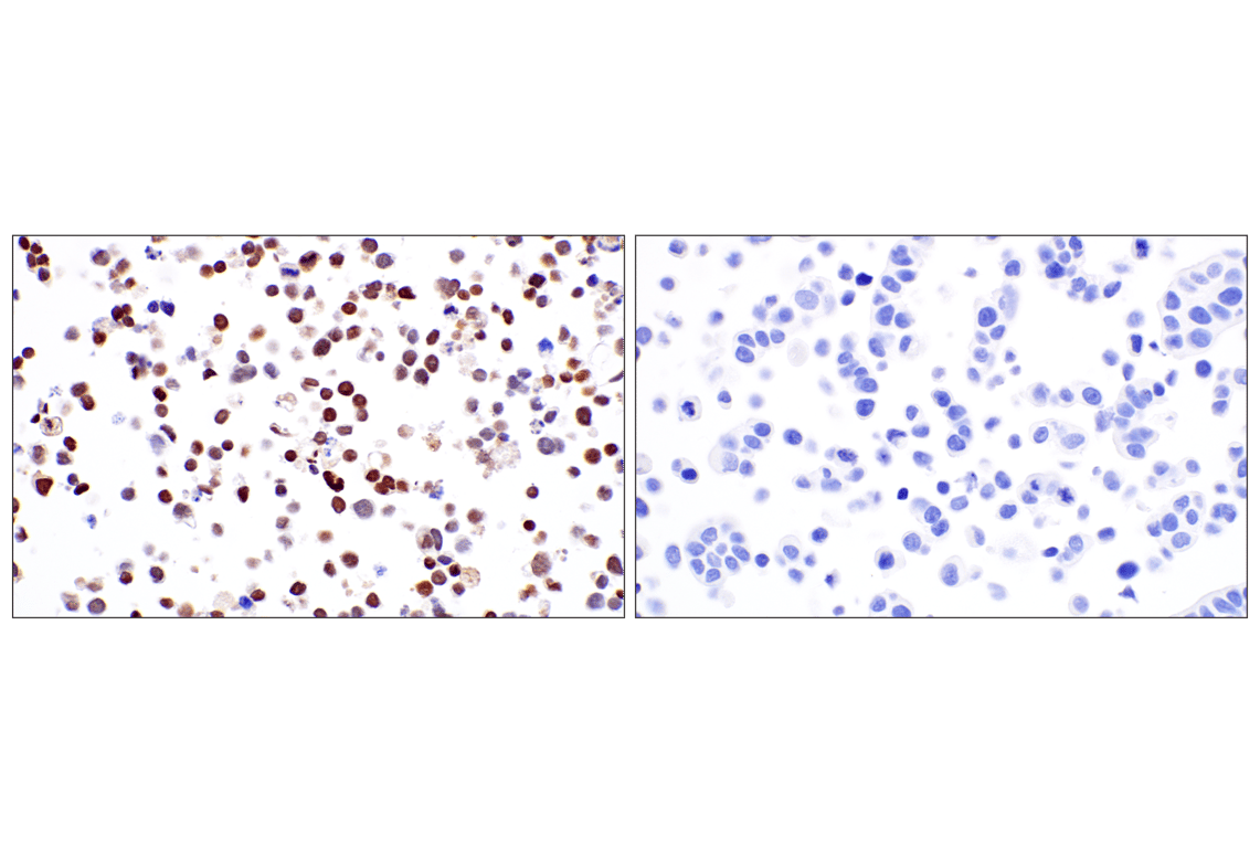 Immunohistochemistry Image 6: SIX3 (F1I1S) Rabbit Monoclonal Antibody