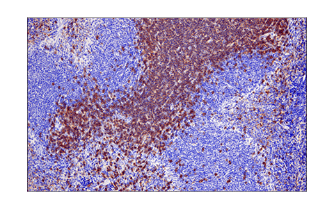 Immunohistochemistry Image 5: LAT (E3U6J) Rabbit Monoclonal Antibody (BSA and Azide Free)