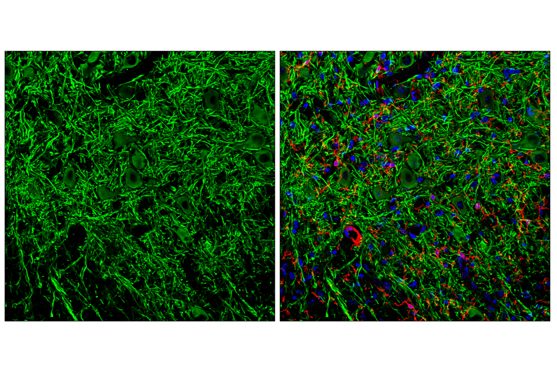 Immunofluorescence Image 3: GPR52 (E9D8W) Rabbit Monoclonal Antibody (BSA and Azide Free)