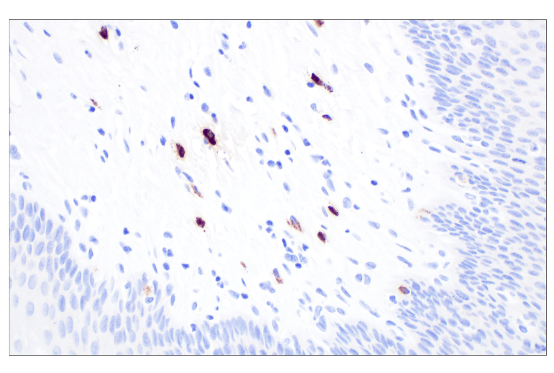 Immunohistochemistry Image 9: Mast Cell Chymase/CMA1 (F6S4Q) Rabbit Monoclonal Antibody