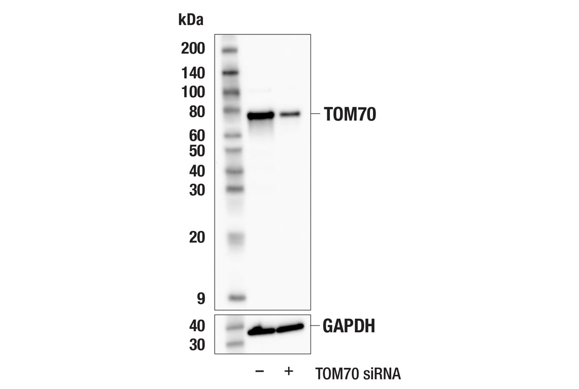 Western Blotting Image 2: TOM70 (E7E1M) Rabbit Monoclonal Antibody