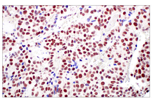 Immunohistochemistry Image 3: MLH1 (ES05) Mouse Monoclonal Antibody