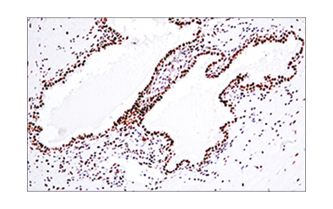 Immunohistochemistry Image 6: 53BP1 (E7N5D) Rabbit Monoclonal Antibody (BSA and Azide Free)