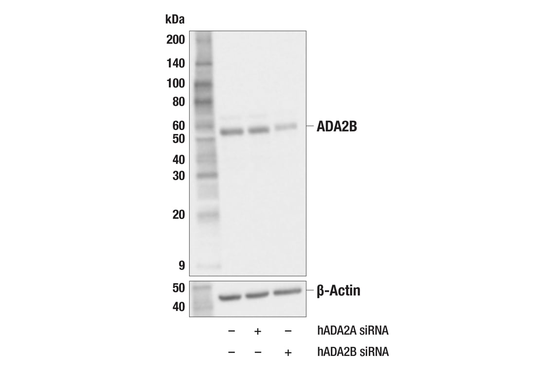 Western Blotting Image 2: ADA2B (F6G5T) Rabbit Monoclonal Antibody