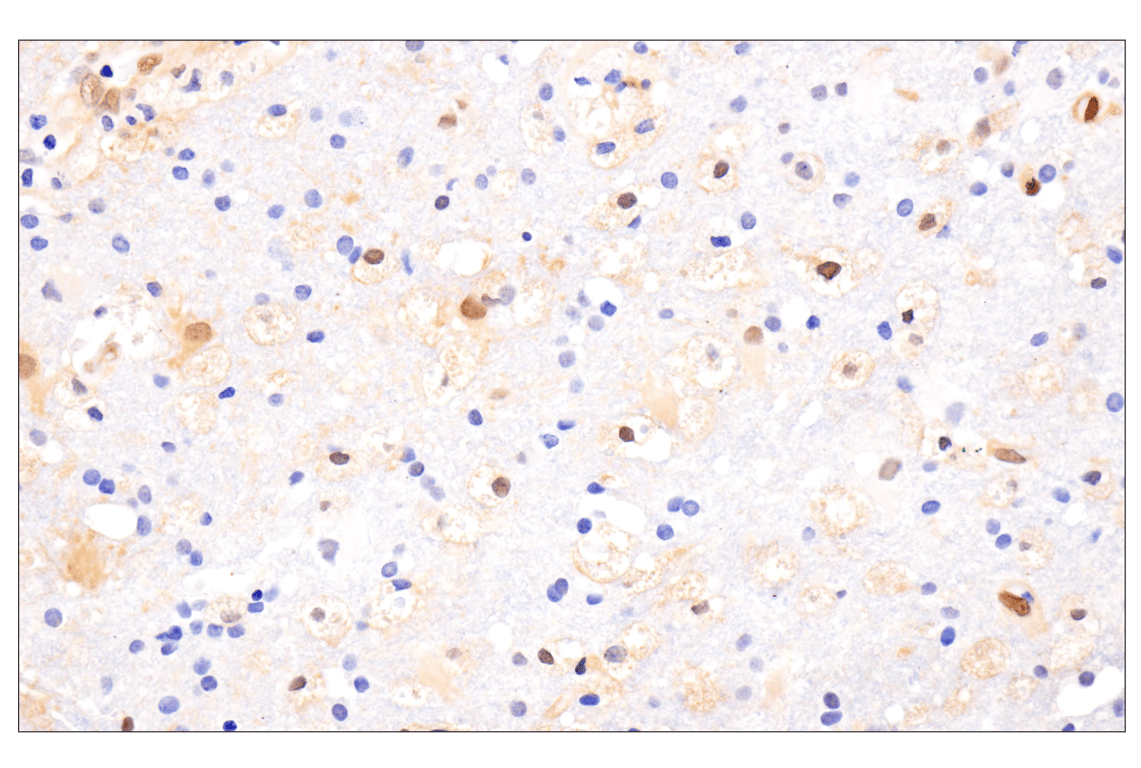 Immunohistochemistry Image 9: Phospho-Stat3 (Ser727) (D4X3C) Rabbit Monoclonal Antibody