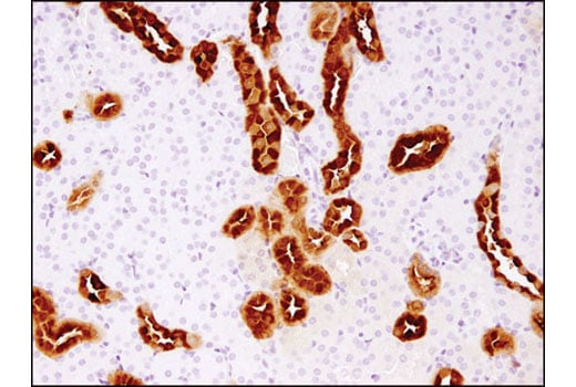 Immunohistochemistry Image 2: Calbindin (D1I4Q) Rabbit Monoclonal Antibody