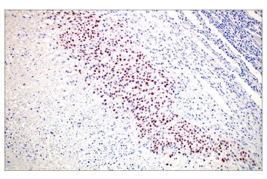 Immunohistochemistry Image 5: PRAME (E7I1B) Rabbit Monoclonal Antibody