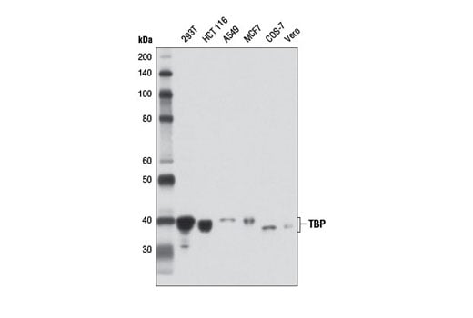 Western Blotting Image 1: TBP (D5G7Y) Rabbit mAb