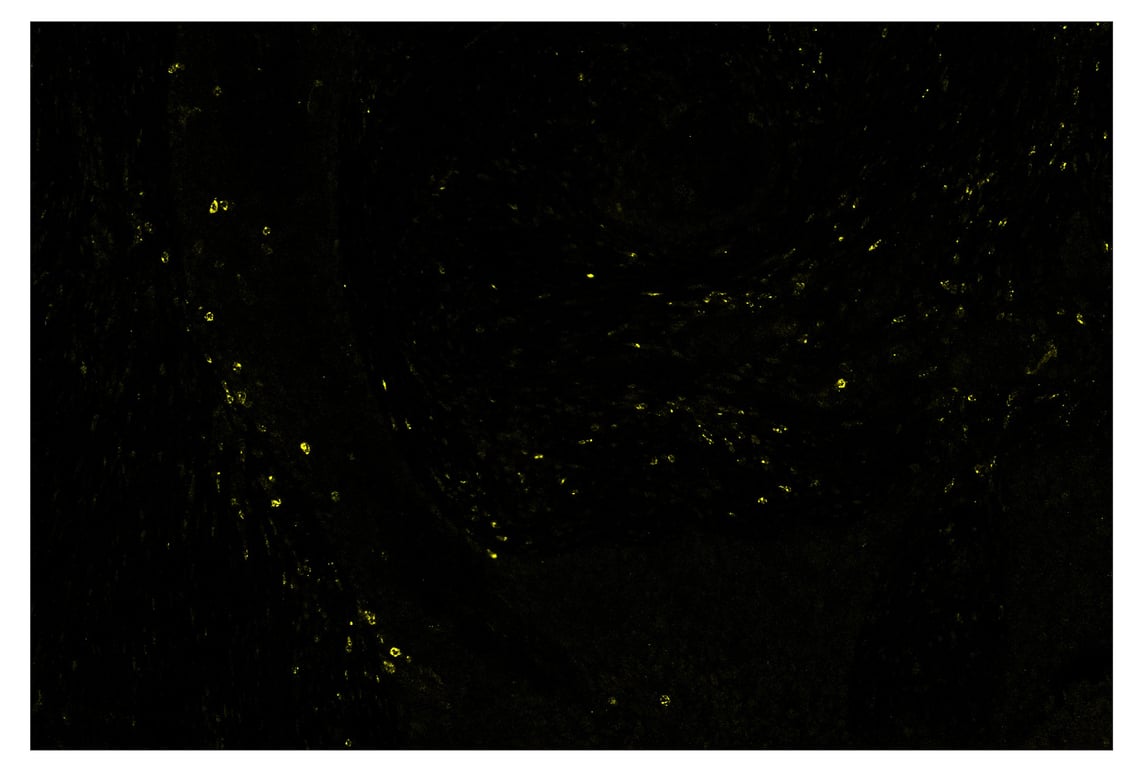 Immunohistochemistry Image 3: LAG3 (D2G4O) & CO-0026-647 SignalStar<sup>®</sup> Oligo-Antibody Pair