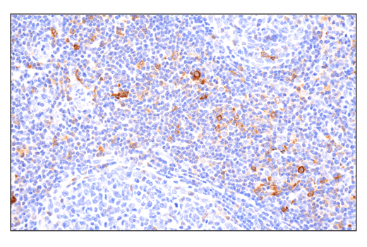 Immunohistochemistry Image 6: Phospho-SLP-76 (Ser376) (E3G9U) Rabbit Monoclonal Antibody