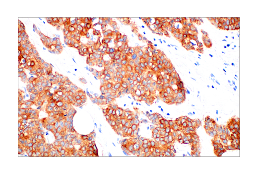Immunohistochemistry Image 2: Pan-Keratin (AE1/AE3) Mouse Monoclonal Antibody