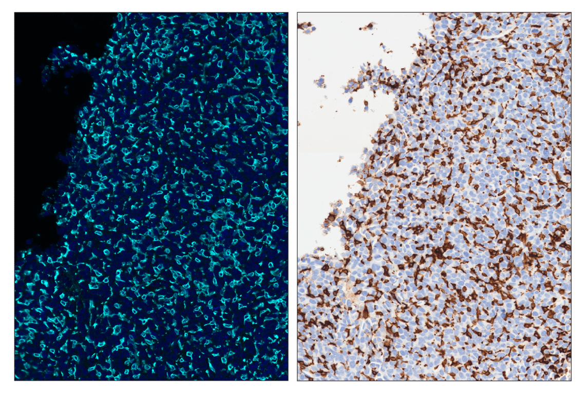 Immunohistochemistry Image 6: CD11b/ITGAM (E4K8C) & CO-0083-488 SignalStar<sup>™</sup> Oligo-Antibody Pair