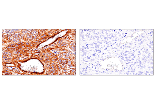 Immunohistochemistry Image 2: CD248 (E9Z7O) Rabbit Monoclonal Antibody (BSA and Azide Free)