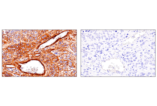 Immunohistochemistry Image 2: CD248 (E9Z7O) XP<sup>®</sup> Rabbit mAb (BSA and Azide Free)