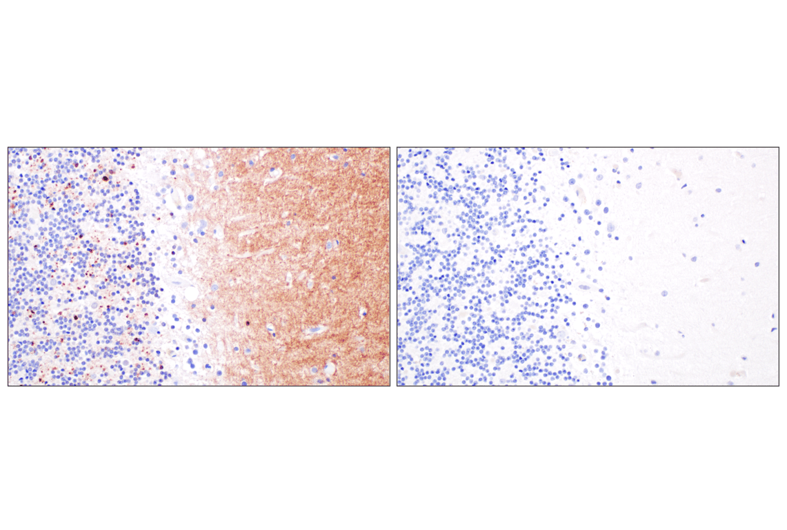 Immunohistochemistry Image 3: Phospho-alpha-Synuclein (Ser129) (D1R1R) Rabbit Monoclonal Antibody