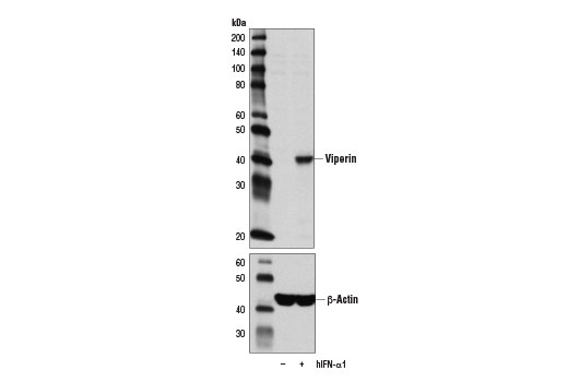 Western Blotting Image 2: Viperin (D5T2X) Rabbit Monoclonal Antibody