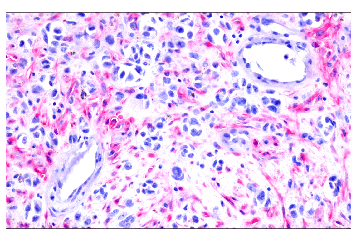 Immunohistochemistry Image 1: FAP (F1A4G) Rabbit Monoclonal Antibody (BSA and Azide Free)
