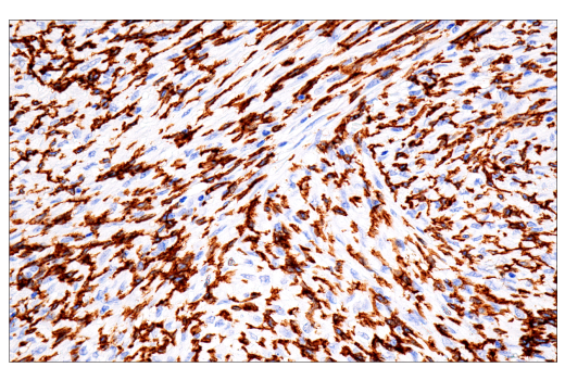 Immunohistochemistry Image 2: FcR gamma (E6Y1A) Rabbit Monoclonal Antibody (BSA and Azide Free)