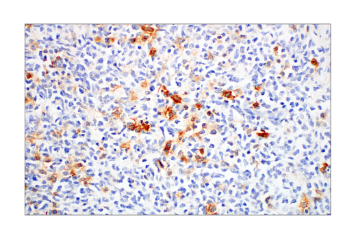 Immunohistochemistry Image 3: TNFRSF8/CD30 (E7E4D) Rabbit Monoclonal Antibody (BSA and Azide Free)
