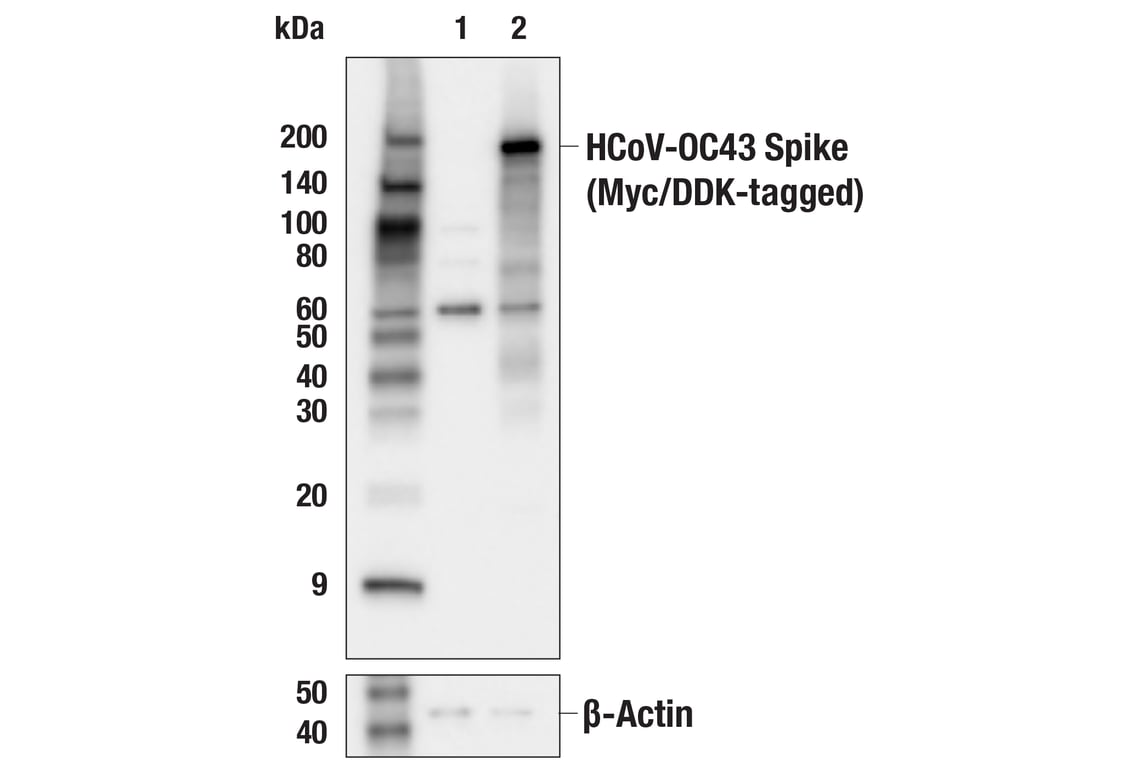 Western Blotting Image 1: HCoV-OC43 Spike Protein (E4U6P) Rabbit mAb