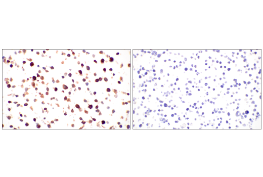 Immunohistochemistry Image 6: TRDC/TCR delta (E2E9T) Rabbit Monoclonal Antibody (BSA and Azide Free)