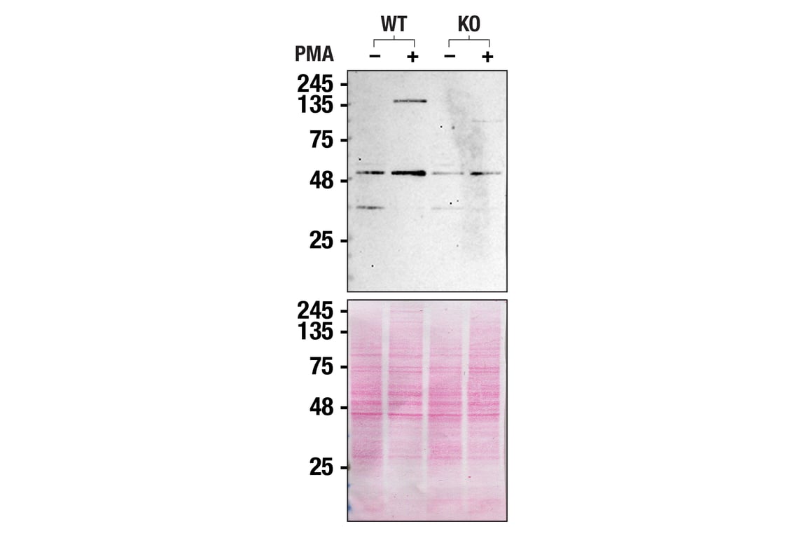 Western Blotting Image 3: PLC gamma2 Antibody