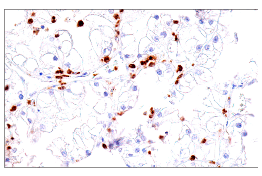 Immunohistochemistry Image 1: CEACAM6 (E7S7Y) Rabbit Monoclonal Antibody (BSA and Azide Free)