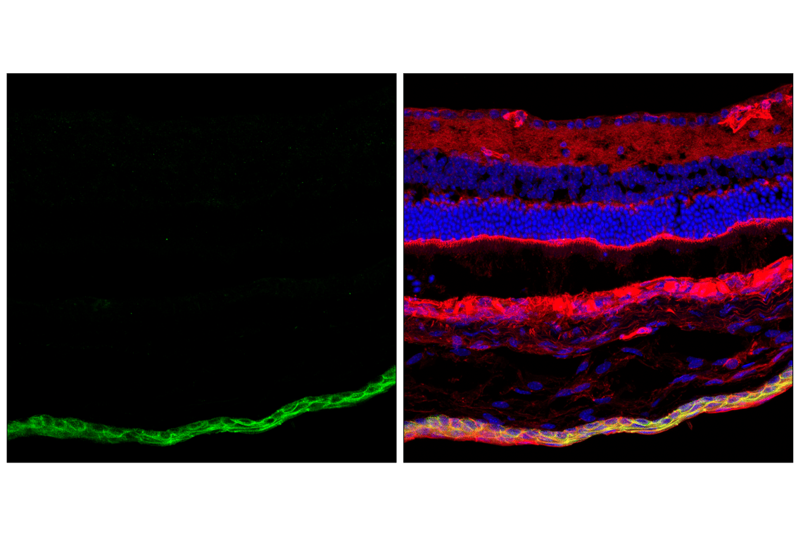 Immunofluorescence Image 3: Desmoplakin (F3J8Y) Rabbit Monoclonal Antibody