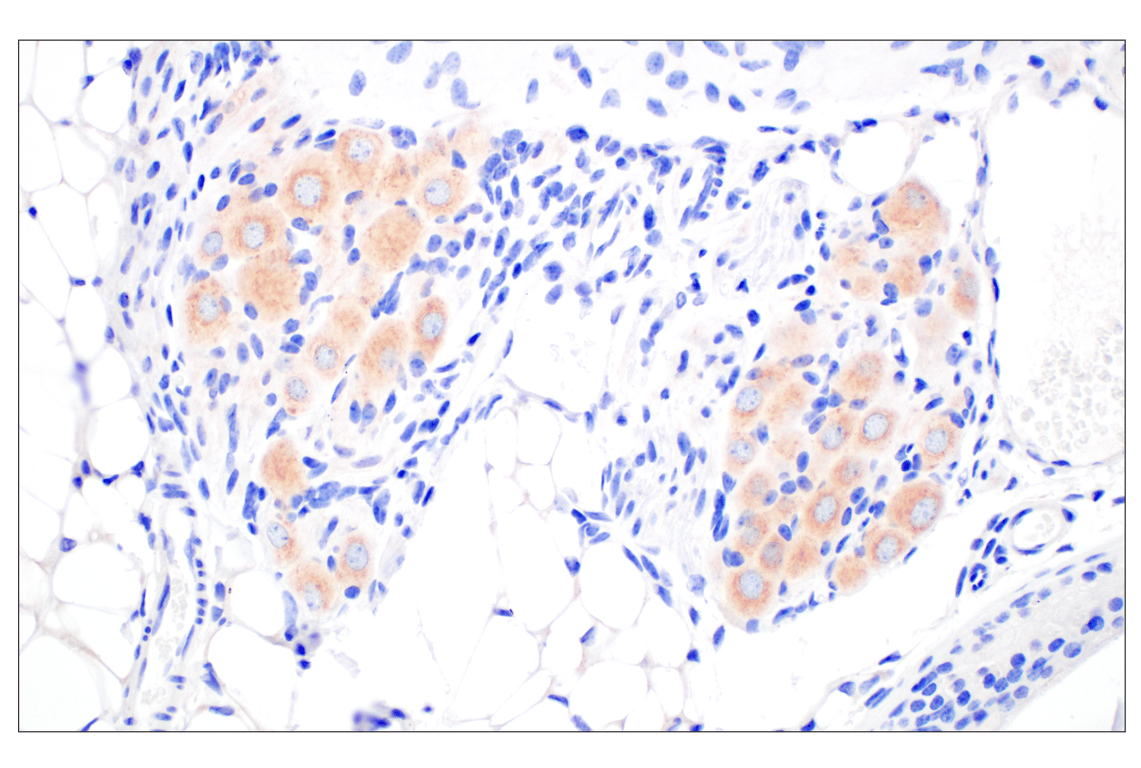 Immunohistochemistry Image 5: BACE1 (F4Z7X) Rabbit Monoclonal Antibody