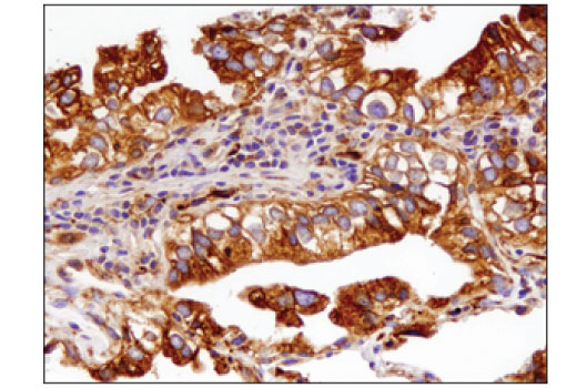 Immunohistochemistry Image 2: Grp94 (D6X2Q) Rabbit Monoclonal Antibody