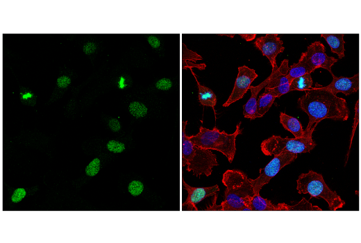 Immunofluorescence Image 1: Aurora B/AIM1 (E3R8N) Rabbit Monoclonal Antibody