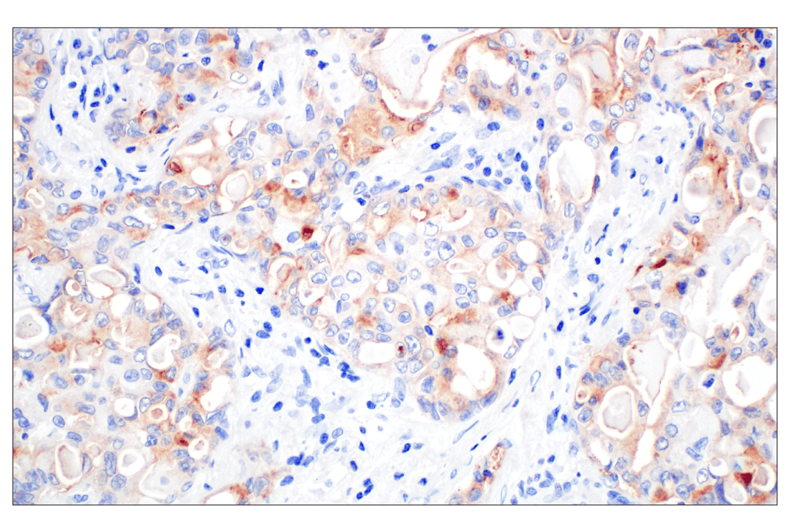 Immunohistochemistry Image 2: Folate Receptor Alpha/FOLR1 (E8U2F) Mouse Monoclonal Antibody (BSA and Azide Free)