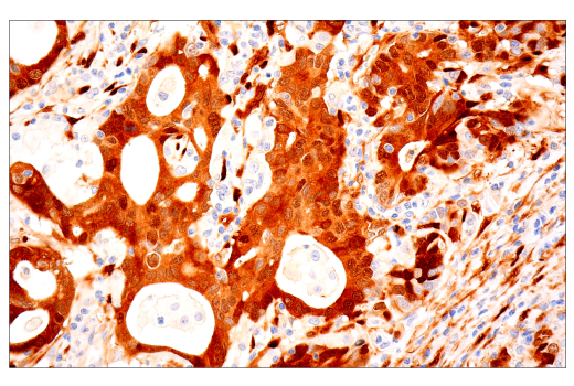 Immunohistochemistry Image 1: YAP/TAZ (E9M8G) Rabbit Monoclonal Antibody (BSA and Azide Free)