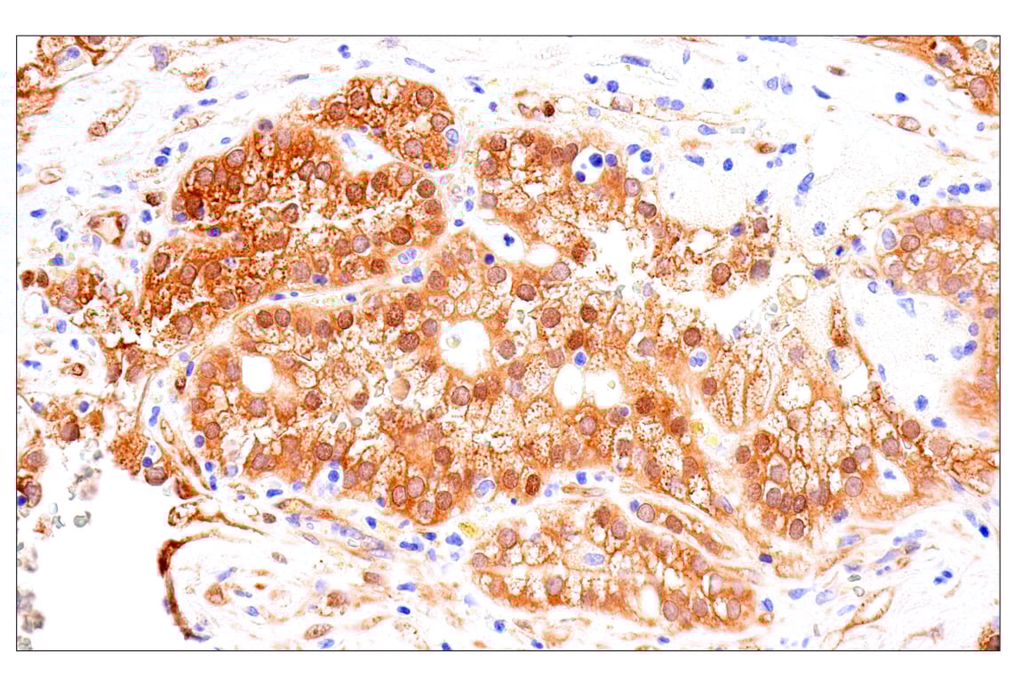 Immunohistochemistry Image 5: Phospho-YAP (Ser61) (E4Q8S) Rabbit Monoclonal Antibody