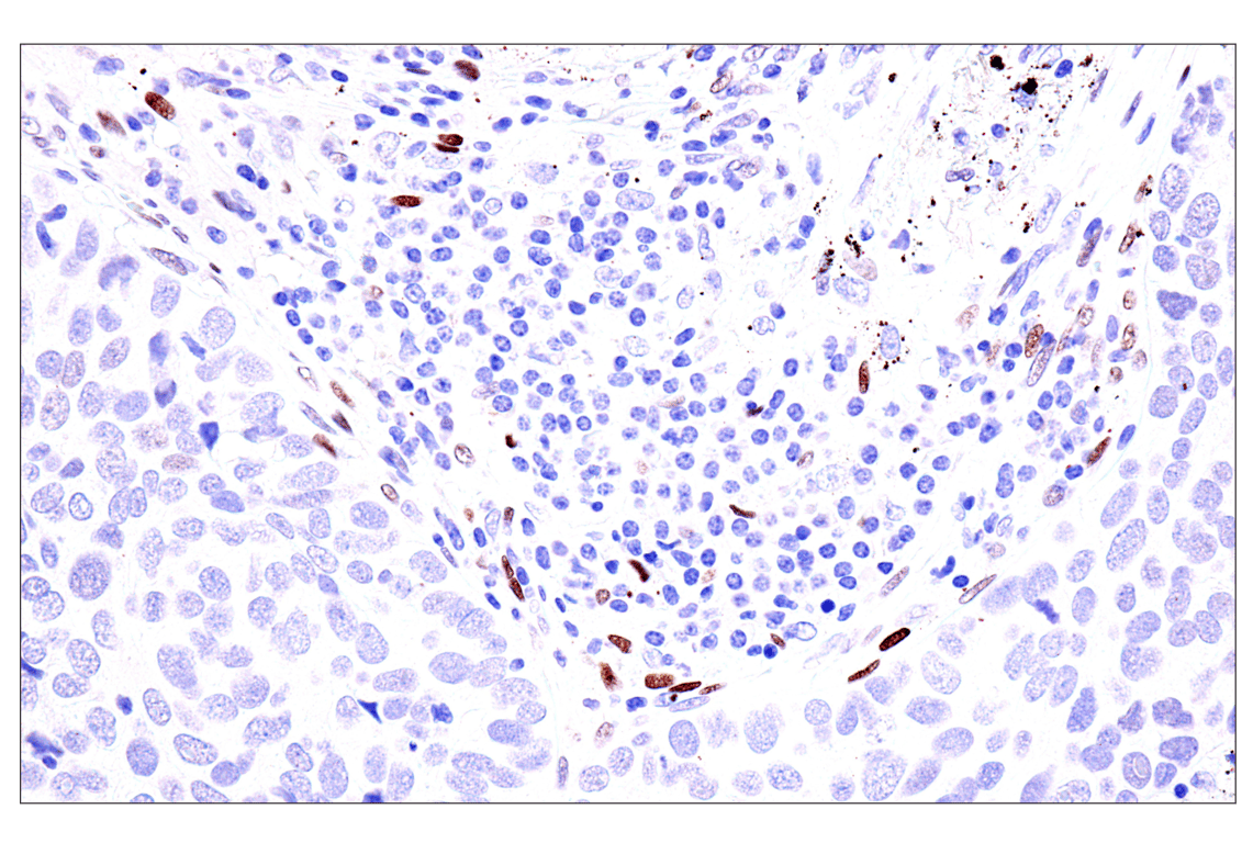Immunohistochemistry Image 5: GATA-6 (D61E4) Rabbit Monoclonal Antibody (BSA and Azide Free)